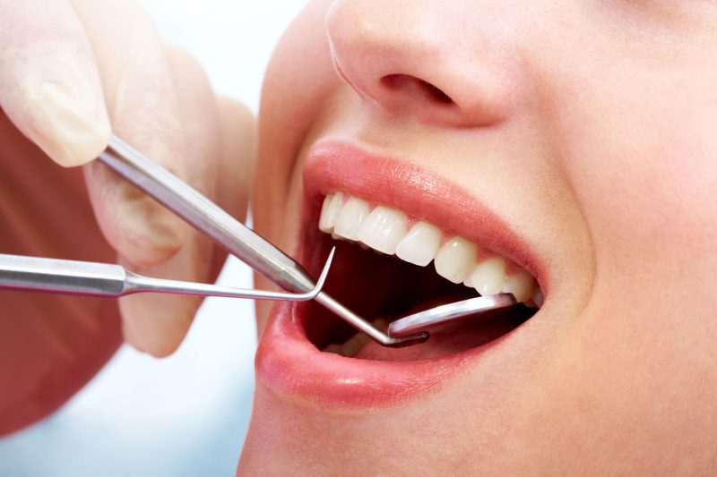 What Should You Know About Teeth Bleaching In Granite Quarry, NC?