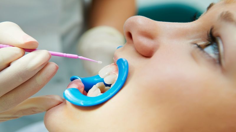 Preventive Dental Care in Tulsa OK Is Crucial for Keeping Children Healthy