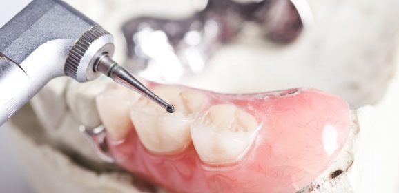 Why Do Patients Choose Dentures In Toronto?