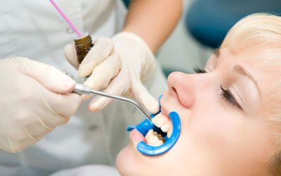 Yes, You should Learn More About Cosmetic Dentist in Spring Lake NJ